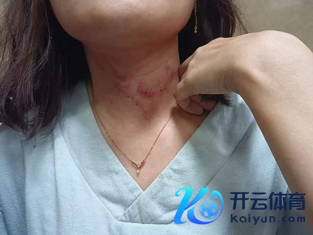 男人凌晨听到呼救发现一女子被勒昏 勇敢市民拍视频吓退歹徒